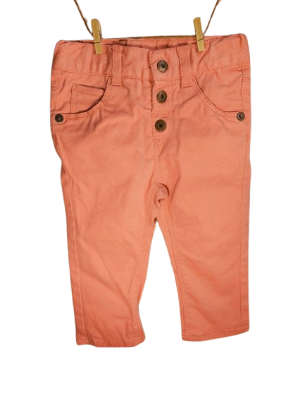 🌸 Mexx Hose – Rosa & Knopfdetails 🌿